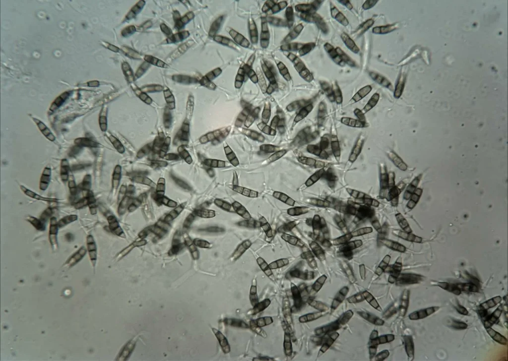 Het geslacht Pestalotiopsis werd voor het eerst beschreven in 1880 in Buenos Aires door de mycoloog Carlos Luigi Spegazzini.